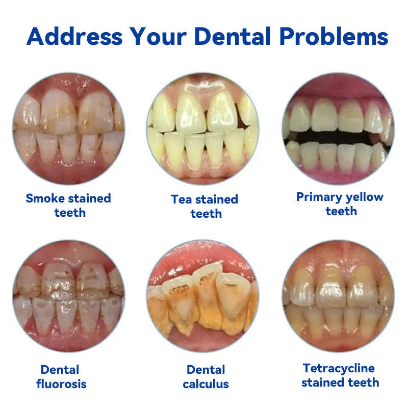 Oraliz™ Anti-Cavity Gum Health Toothpaste (Dentist Recommended) - EVERRD USA