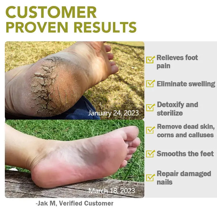 NatureFoot™ Essential Oil FootBath Effervescent Tablets - EVERRD USA