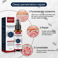 MEDix™ Herbal Psoriasis Therapy Spray - EVERRD USA